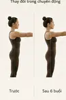 So sánh tư thế trước và sau